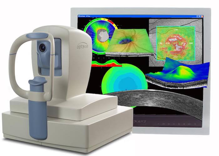 Optical Coherence Tomography (OCT) Scanning