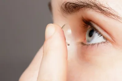Myopia management and orthokeratology